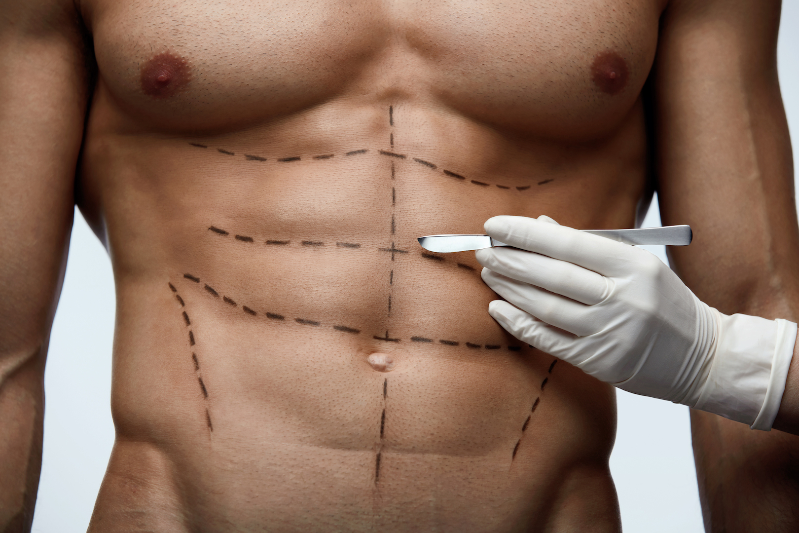 Male plastic surgery on the rise